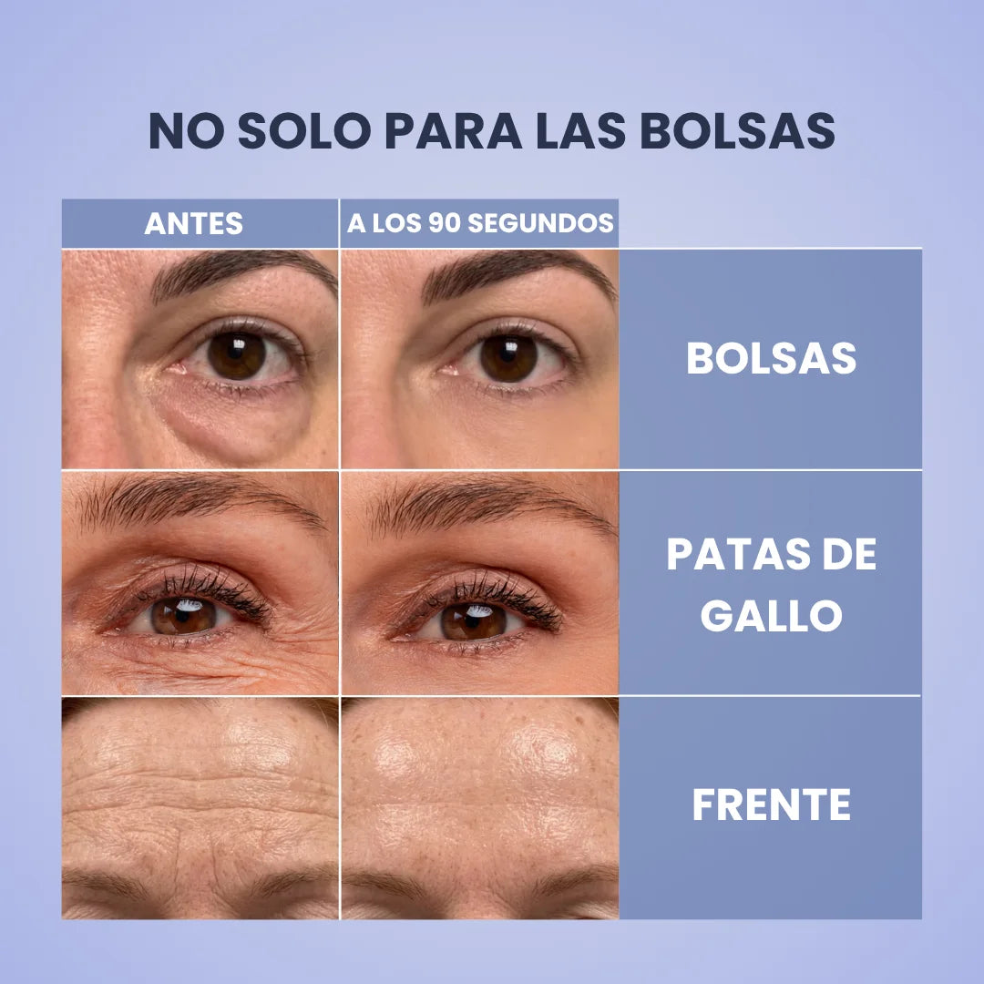 Gel Tensor Instantáneo para Bolsas y Ojeras (20ml)