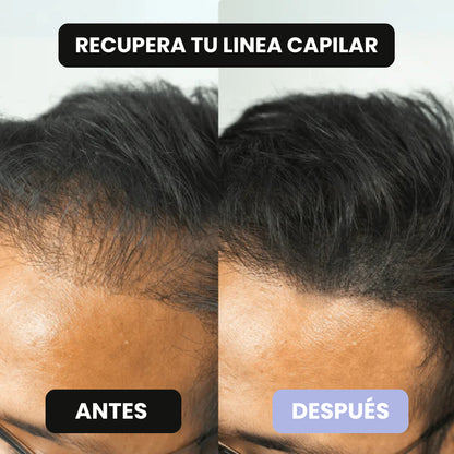 Polvo Rellenador Capilar