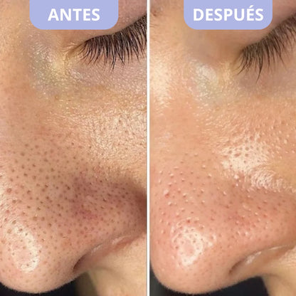 Sérum Exfoliante Coreano - Dr.Melaxin