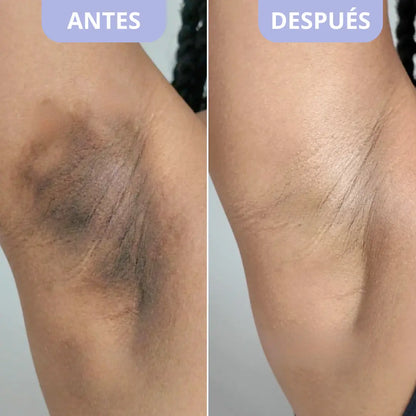 Exfoliante Corporal para Zonas Oscuras – Dr. Melaxin