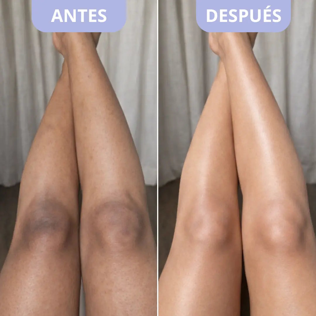 Exfoliante Corporal para Zonas Oscuras – Dr. Melaxin