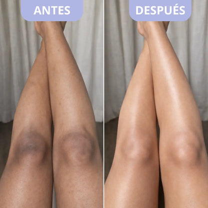 Exfoliante Corporal para Zonas Oscuras – Dr. Melaxin