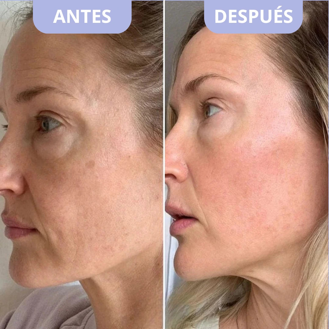 Bálsamo Coreano Efecto Lifting – Dr.Melaxin