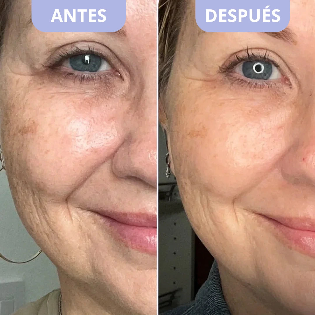 Bálsamo Coreano Efecto Lifting – Dr.Melaxin