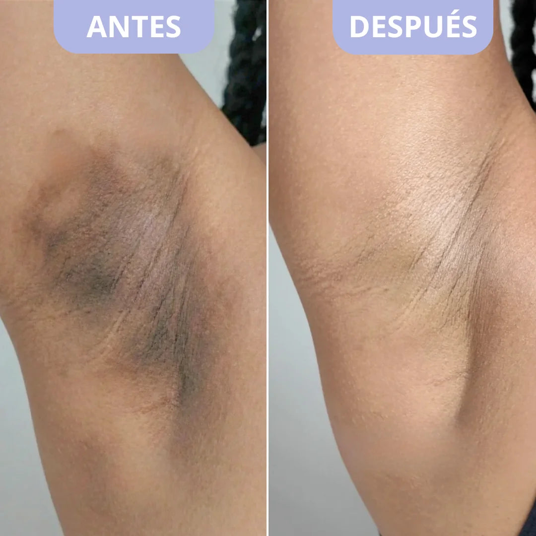 Exfoliante Corporal para Zonas Oscuras – Dr. Melaxin