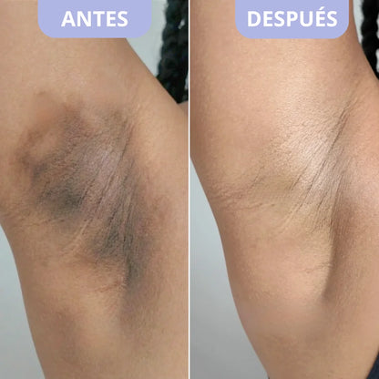 Exfoliante Corporal para Zonas Oscuras – Dr. Melaxin