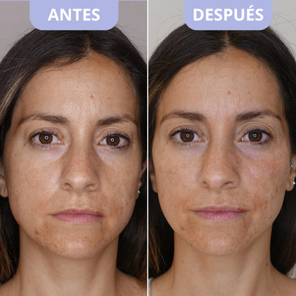 Parches Coreanos Antifatiga – Dr.Melaxin