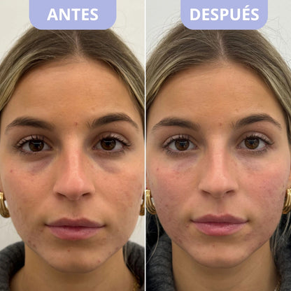 Parches Coreanos Antifatiga – Dr.Melaxin