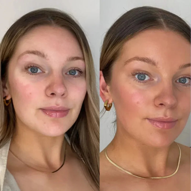 Bronceado natural