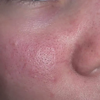 Sérum Exfoliante Coreano - Dr.Melaxin (80ml)